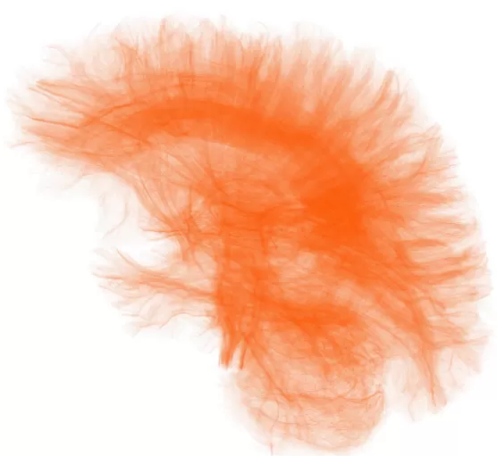 Imagerie du cerveau : fibres cérébrales orange