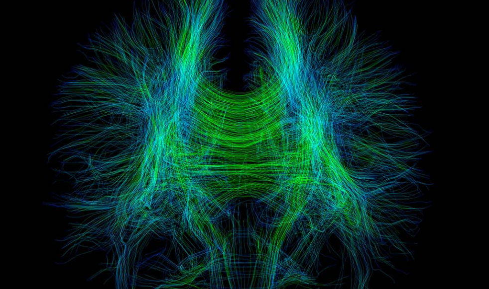 Diffusion Tensor Imaging