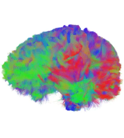 Brain scan : Green, pink and purple brain fibers