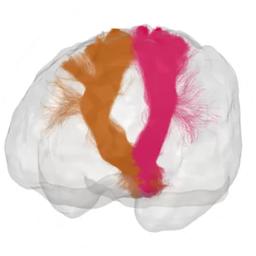 Brain scan : orange and pink brain fibers