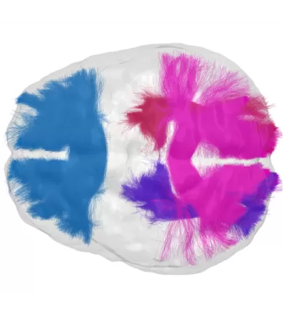 Brain scan : Blue, pink and purple brain fibers