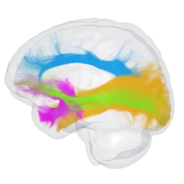 Brain scan : Blue, green, yellow and pink brain fibers