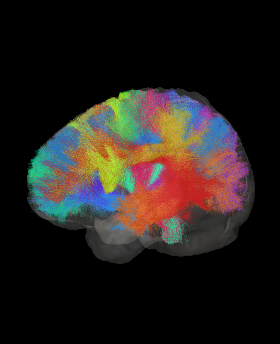 Diffusion Tensor Imaging