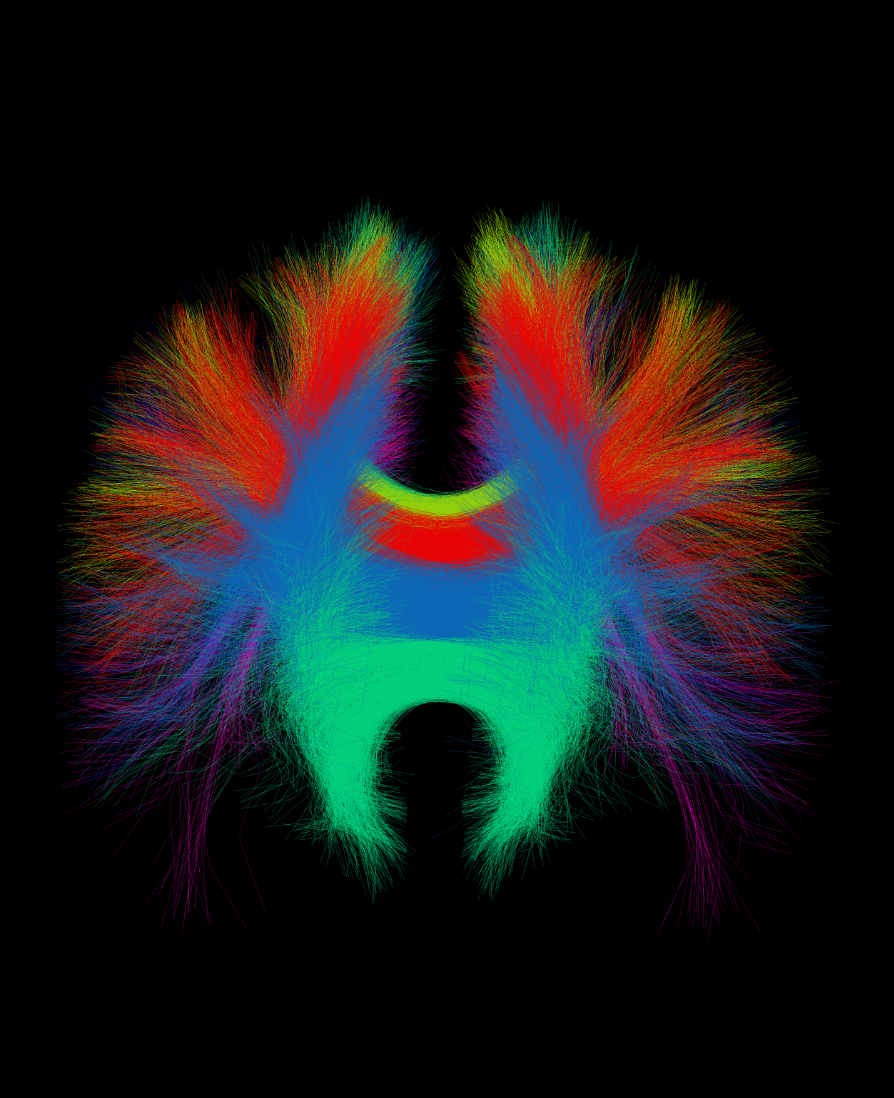 Diffusion Tensor Imaging