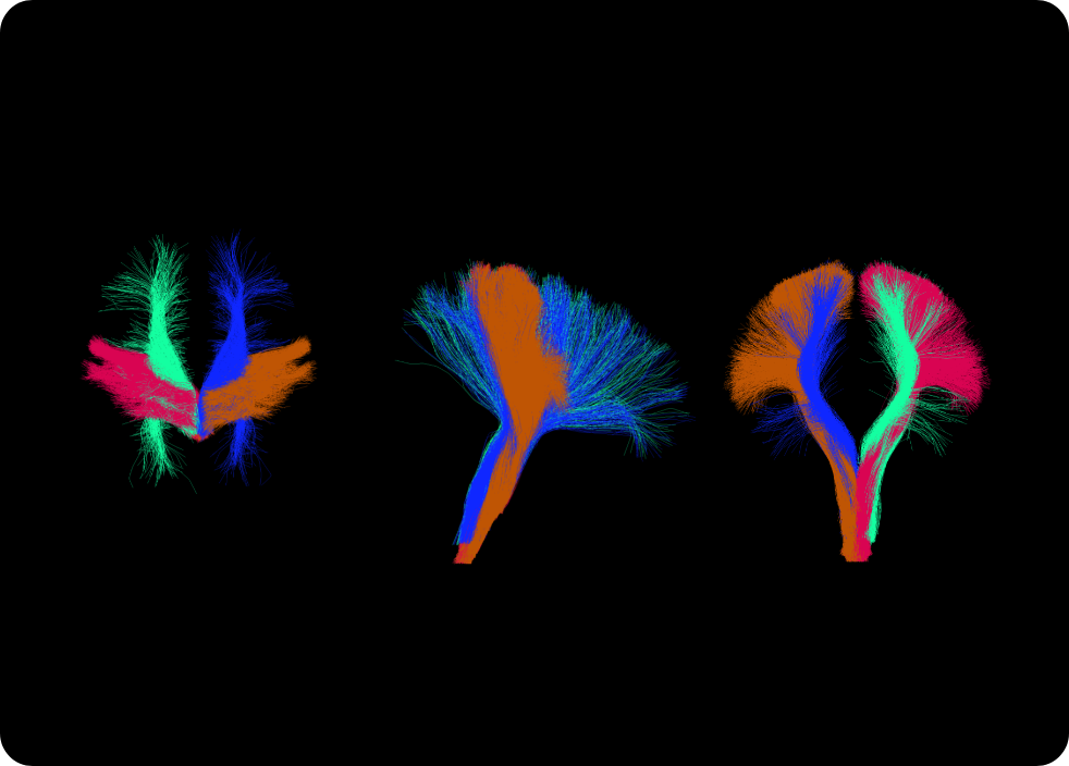 Diffusion tensor imaging : different views