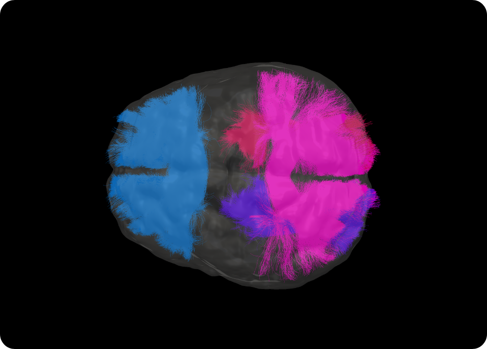 Brain scan