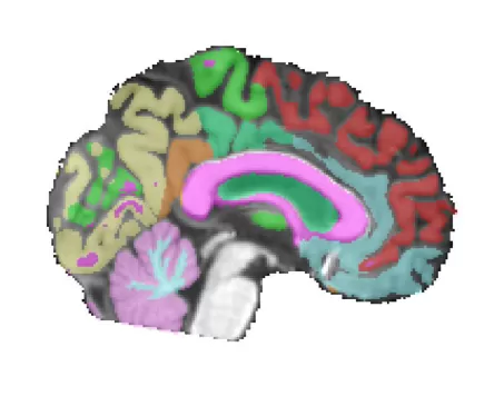 Brain scan : Blue, orange and green brain fibers